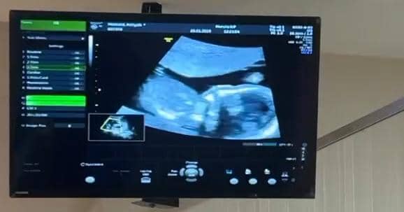 Instagram.com/aaliyah.massaid